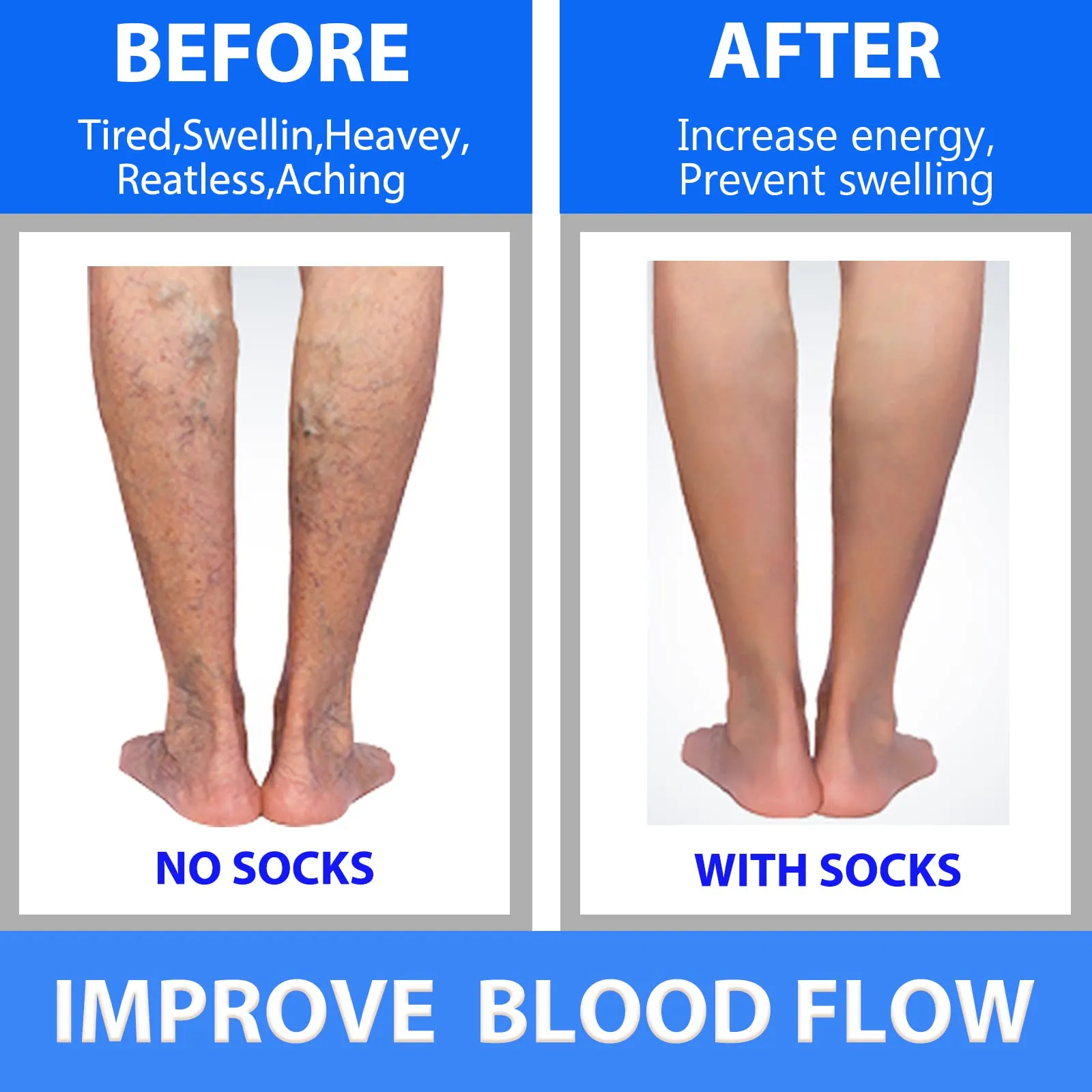 3 Pairs Zippre Compression Socks - Calf Knee High Open Toe Compression Stockings 15-20mmHg for Walking,Running 01 Nude Large-X-Large