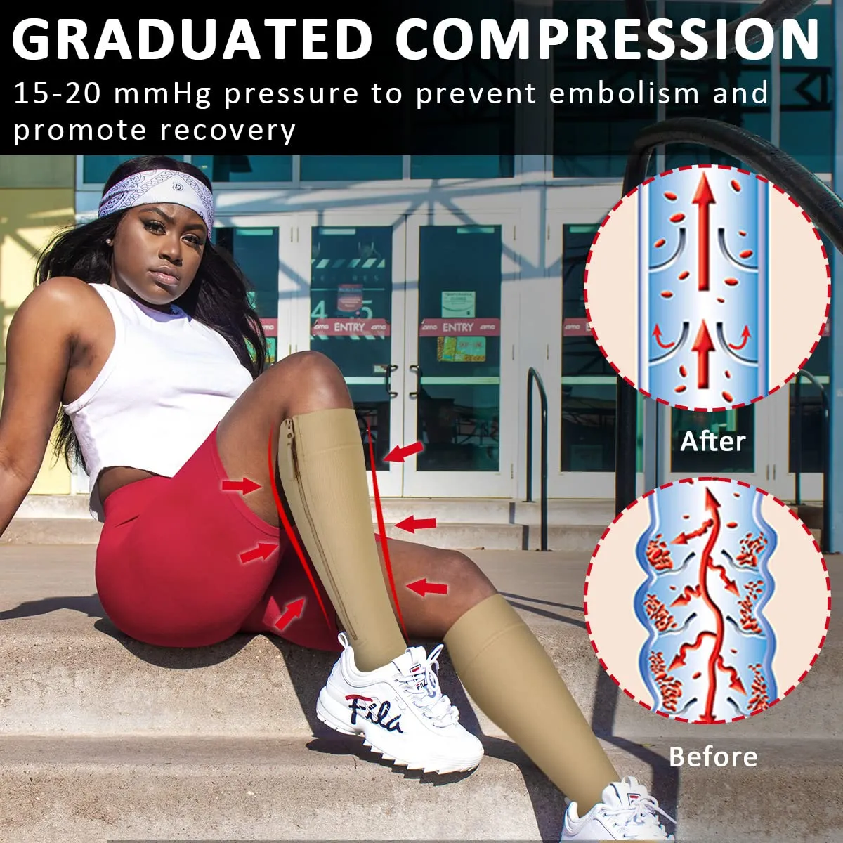 Ailaka Compression Stockings with Zipper, 15-20 mmhg Class 1 Compression Stockings for Men and Women, Support Stockings with Open Toes for Varicose Veins, Edema, Recovery, Pregnant Large (1 Pair) Beige